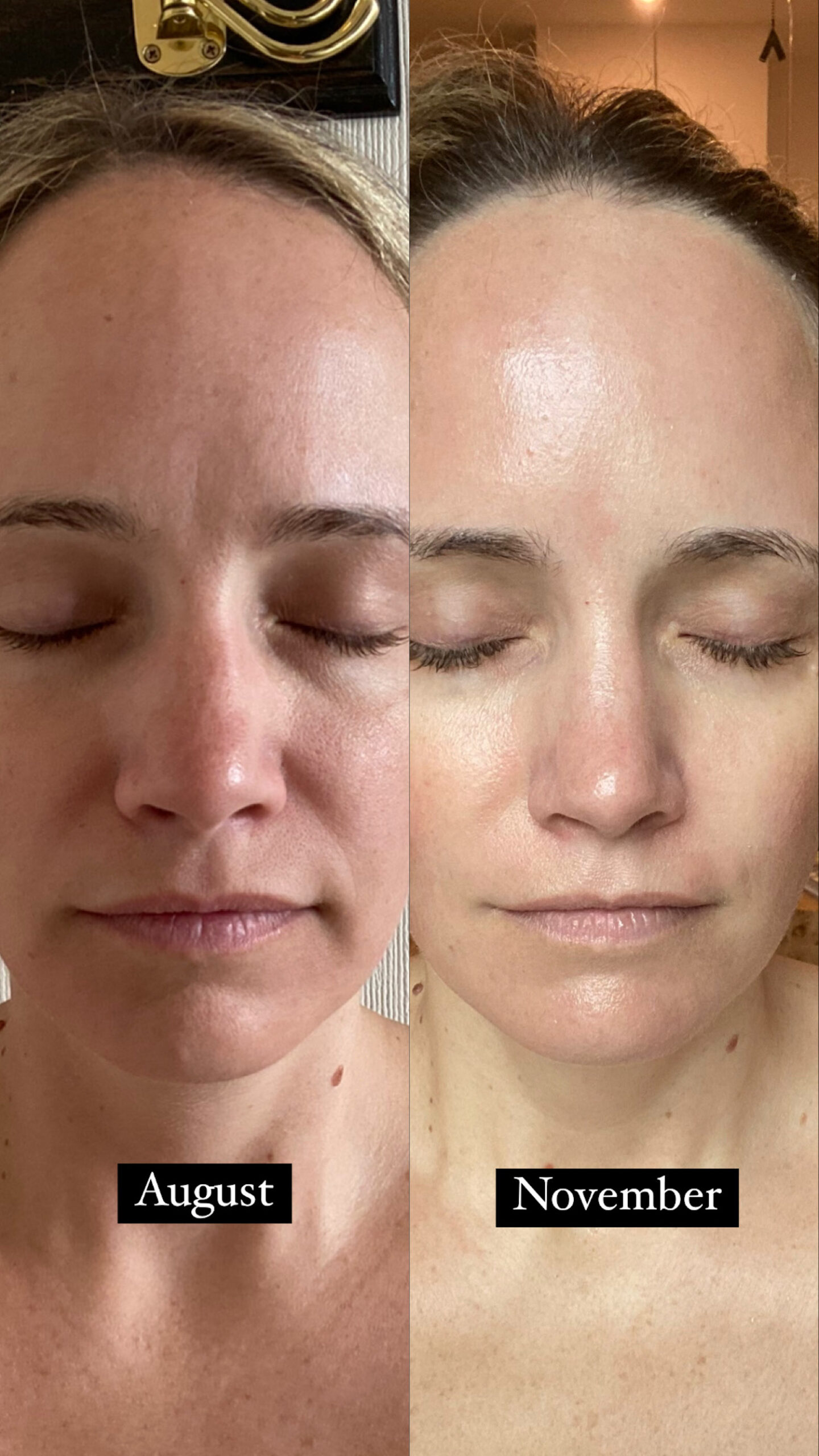 Grandelash MD Lash Enhancing Serum Review Grandelash MD Lash Enhancing Serum Review